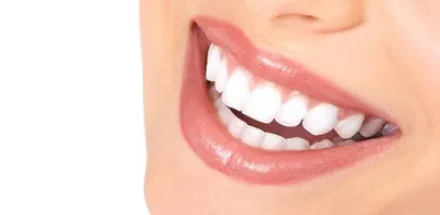 Голливудская улыбка - Bagcilar Dental Clinic