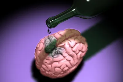 Как снять головную боль после алкоголя, как избавиться от головной боли при  запое? Народные методы + советы нарколога