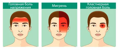 Головная боль - Государственное учреждение здравоохранения "Детская  областная больница"