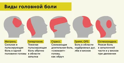 Посттравматическая головная боль - лечение, симптомы, причины, диагностика  | Центр Дикуля