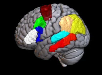 Головной мозг MPT 3D : нормальная анатомия | e-Anatomy