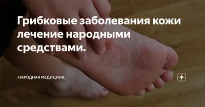 Грибковые заболевания кожи лечение народными средствами. | Народная  медицина. | Дзен