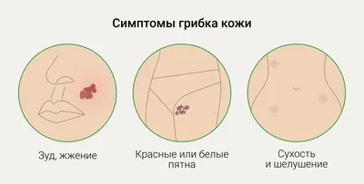 Советы | Лицо, Советы, Микоз