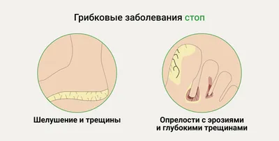 Раствор для наружного применения для лечения угревой сыпи ЯДРАН Зеркалин -  «Помог. Действительно помог избавиться от катастрофы на лице.» | отзывы