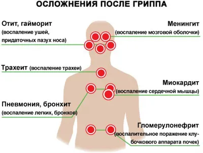 Грипп, коронавирусная инфекция и другие острые респираторные вирусные  инфекции (ОРВИ)