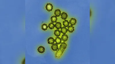 Одним мазком: диагностировать грипп и COVID будут одновременно | Статьи |  Известия