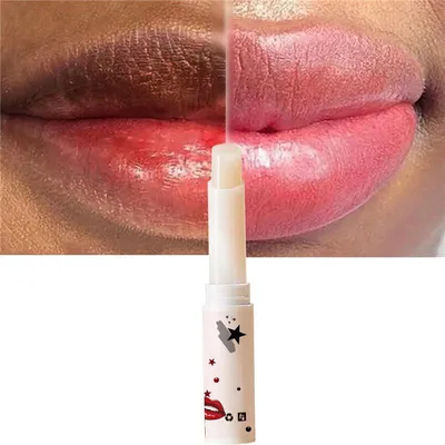 Lips Pink Fresh Lightening Bleaching Cream Treatment Remove Dark Smoke Lips  18g | eBay