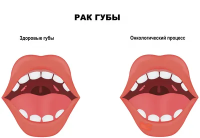 Масло для губ Influence Beauty Двухфазное Lava Lip Oil Biphase Lip oil -  «Пробирка с кровью от Influence» | отзывы