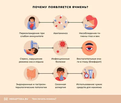 Как лечить ячмень? Советы