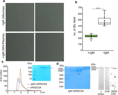 IgM Purification Using a Novel Affinity Ligand - BioProcess  InternationalBioProcess International