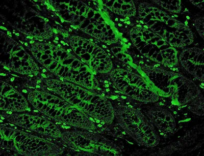 SARS-CoV-2 vaccination elicits unconventional IgM specific responses in  naïve and previously COVID-19-infected individuals - eBioMedicine