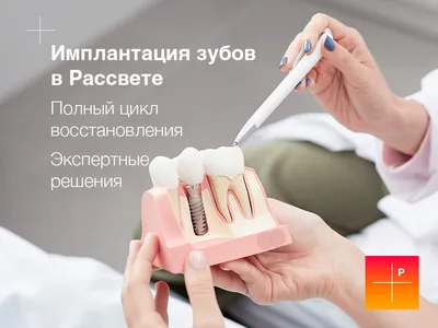 Имплантация зубов в Перми - импланты зубов от 25 тыс. рублей