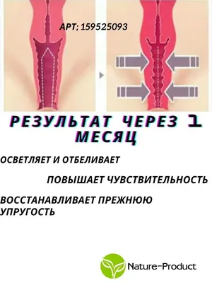 Папилломы на интимных местах / Разбор проблемы и методы решения