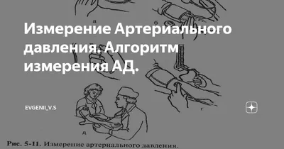 Как измерять артериальное давление - Научно-исследовательский институт  кардиологии