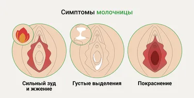 Все о кандидозе и его лечении — кандидоз кожи, полости рта и не только –  что делать | О здоровье: с медицинского на русский | Дзен