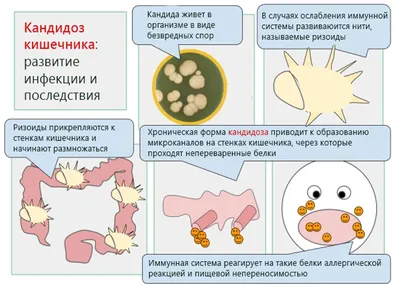 Грибок кожи головы – лечение грибка головы в Москве, цены – An-Tech Labs