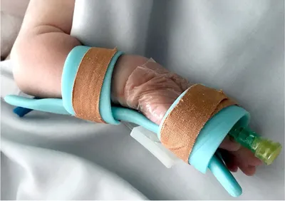 10-месячную девочку с COVID-19 и двусторонней пневмонией спасают в больнице  Волгограда
