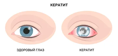 Как определить форму глаз и правильно подобрать макияж - Лайфхакер