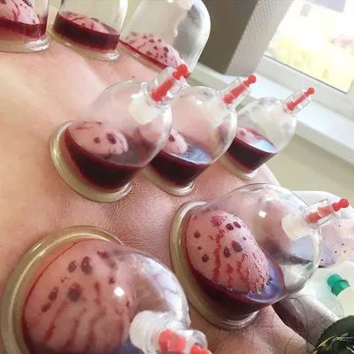 Hijama centr — Yandex Maps