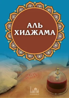 Все, что вы хотели знать о хиджаме – древней, но остромодной методике  оздоровительного кровопускания | Tatler Россия