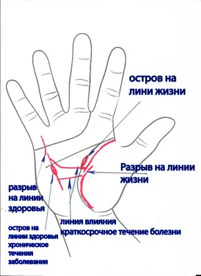 Хиромантия - сказка или реальность... Формула здоровья на ладони... Часть  вторая | Академия Ландшафтного Творчества | Дзен