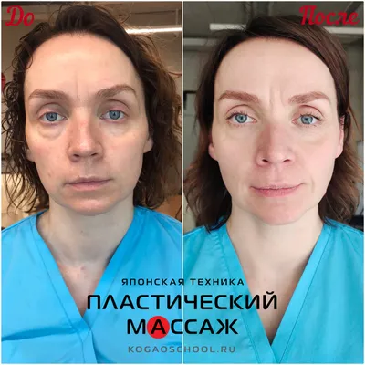 Классический массаж лица