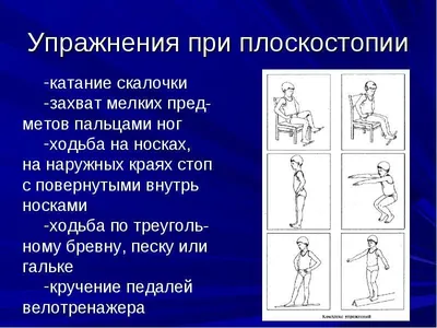 Роль физических нагрузок и ЛФК в лечении плоскостопия у детей. | Единая  служба социального сопровождения детей-инвалидов Московской области “ДАР”