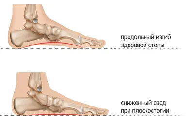 Тренировка для стоп: 15 укрепляющих упражнений 👣 | Здоровье с  | Дзен