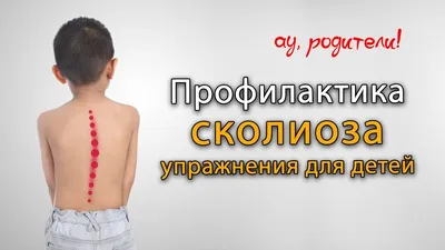 Как тренироваться при сколиозе? Упражнения для укрепления спины