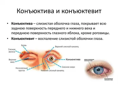 Дакриоцистит. Воспаление слёзного мешка. Барселона. ICR