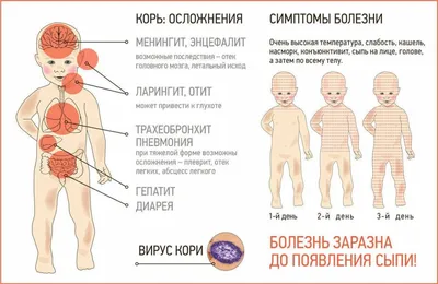 КОРЬ. СИМПТОМЫ и МЕРЫ ПРОФИЛАКТИКИ