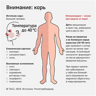 Как распознать корь: советы врача (фото) - «ФАКТЫ»