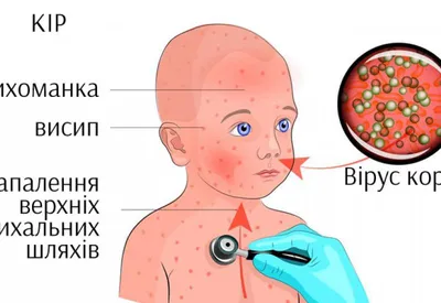 Иркутская городская клиническая больница № 8"