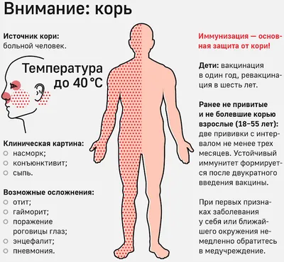 Профилактика кори - Национальный центр Медицины РС(Я), Республиканская  больница №1