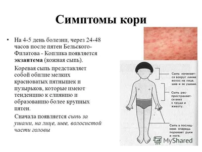 РЕКОМЕНДАЦИИ ГРАЖДАНАМ: корь