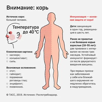 Дерматолог рассказала, как отличить корь от ветрянки