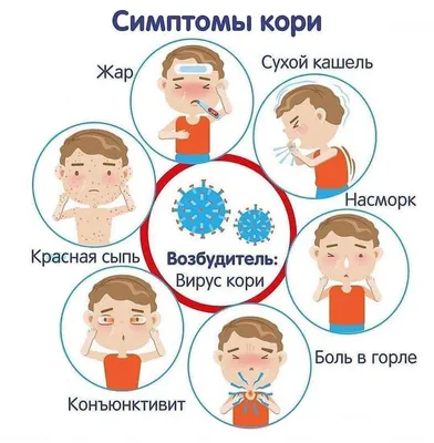 Роспотребнадзор перечислил симптомы кори - РИА Новости, 