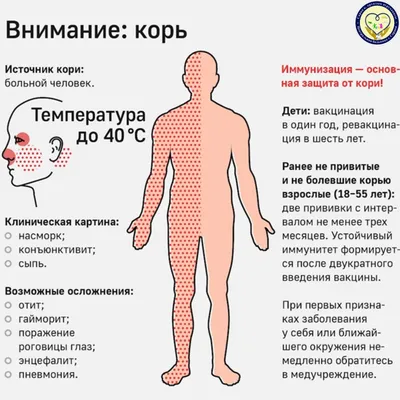 Корь: симптомы, как проявляется, лечение, как узнать, есть ли иммунитет