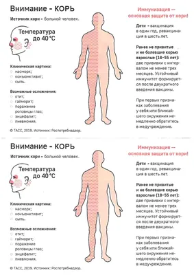 В России участились вспышки кори. Как защититься от смертельно опасной  болезни |  | Волгодонск - БезФормата