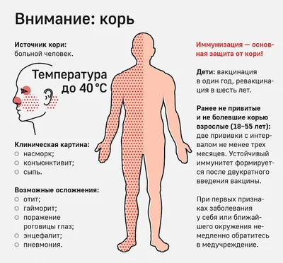 Симптомы и лечение кори у детей | Добромед