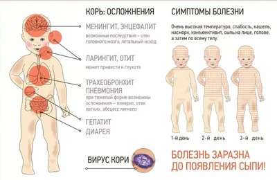 ПРОФИЛАКТИКА КОРИ. ПАМЯТКА ДЛЯ НАСЕЛЕНИЯ