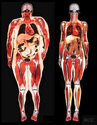 пластическая анатомия кости человека: 13 тыс изображений найдено в  Яндекс.Картинках | Анатомия человека искусство, Анатомия человека, Анатомия