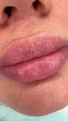 Самые красивые губы знаменитостей