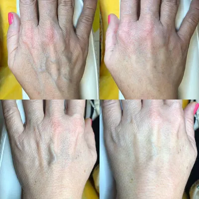 Красивые руки - полезная статья от центра косметологии и подологии  «PrimaDerm»