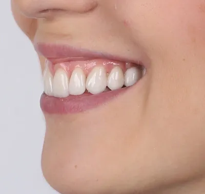 Красивая улыбка - Центр ортодонтии №1