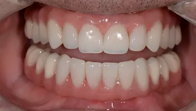 Зубы и психология: взаимосвязь между улыбкой и самооценкой - Мои Родные