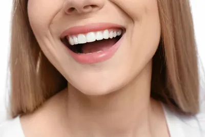 Красивые Зубы | 