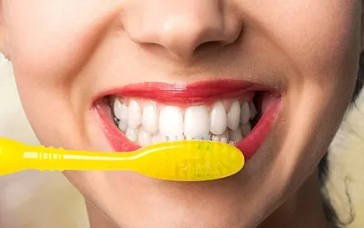 Как форма коронок зубов сделает вас моложе и привлекательнее | Альянс  бьюти-ортопедов, Москва