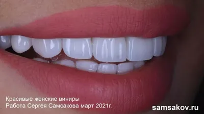 Красивые зубы - показатель здорового организма