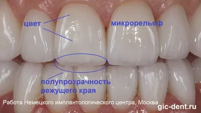 Что определяет понятие «здоровые и красивые зубы»? | Немецкая стоматология  доктора Гроссманна